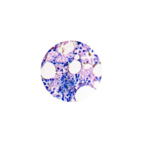 Giemsa Stain Kit (May-Grunwald)